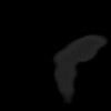 SPORK, NICO - 22.03.1976 - 02.08.2022 - CT obere Extremität - 17:59:07